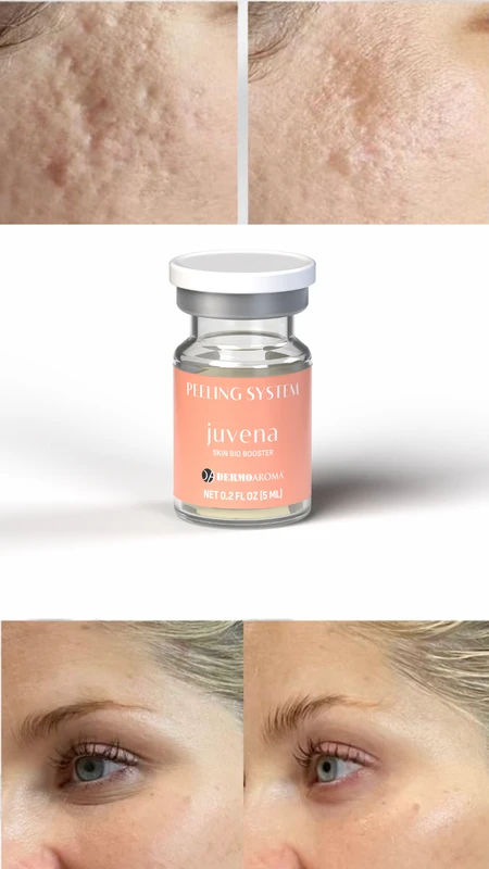 JUVENA Skin Bio Booster pre i posle &ndash; studija slučaja 1