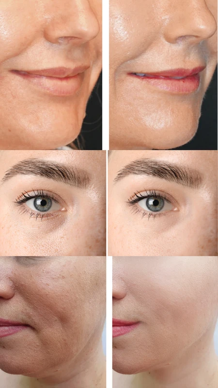 JUVENA Skin Bio Booster pre i posle &ndash; studija slučaja 2